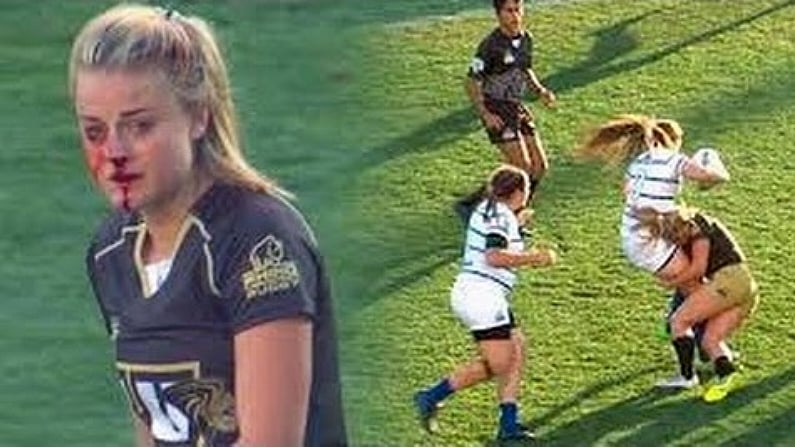 Video: Incredible Commitment From Women's Rugby Player Despite Broken Nose