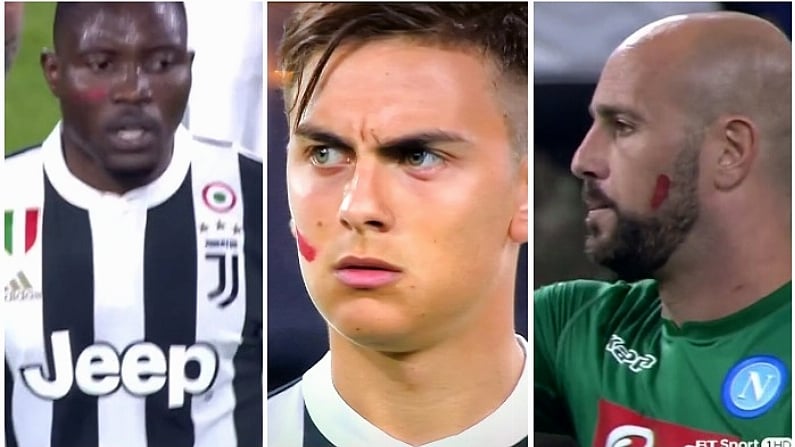 The Brilliant Reason Why Juventus And Napoli Have Red Marks On Their Face