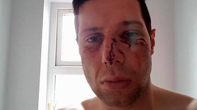 Sean Cavanagh Says He Remains 'Heavily Concussed' Following Facial Injury