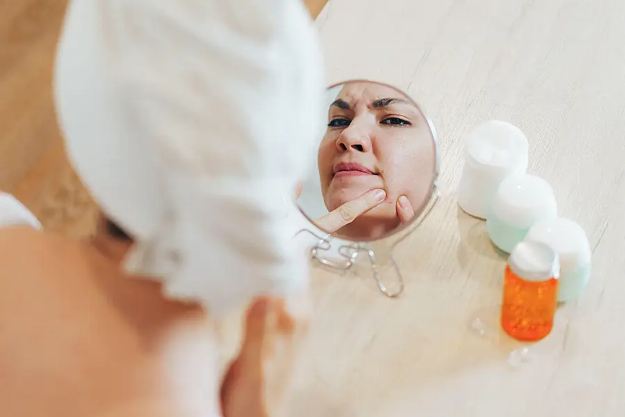 Woman squeezing blackheads on her face in a mirror