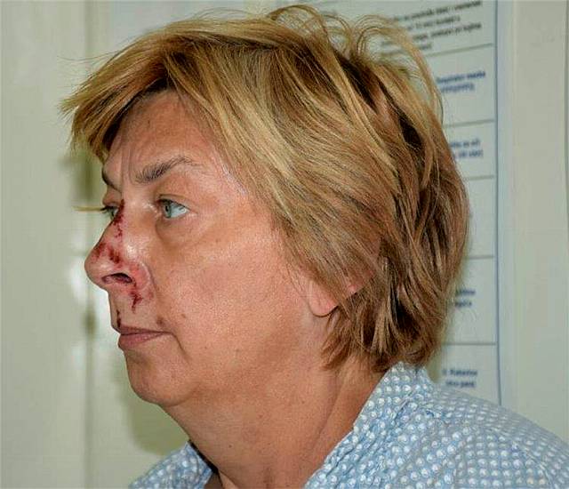 Croatian Police Identify Woman Found With Memory Loss On Adriatic Island