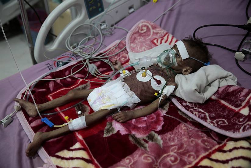 Millions Facing Starvation In Yemen, Un Food Agency Warns