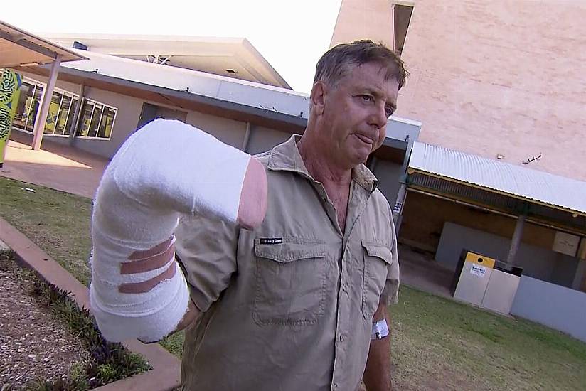 Australian Tour Operator Has Lucky Escape In Crocodile Attack