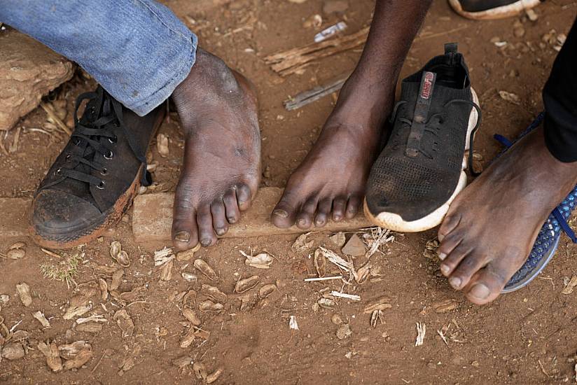 Toes-For-Cash Hoax Reflects Zimbabwe Fears Of Soaring Prices