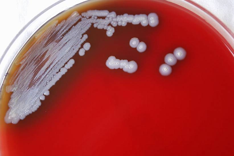 Bacteria That Causes Rare Tropical Disease Found In Us Soil