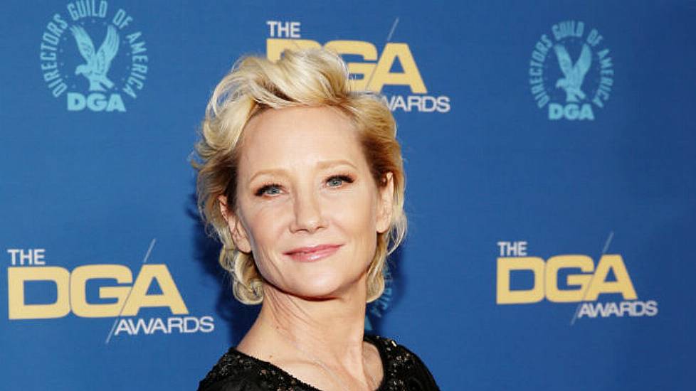 Anne Heche Died Due To Smoke Inhalation And Burns, Coroner Rules