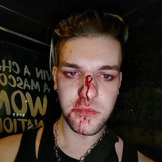 Young Man Assaulted In Suspected Homophobic Attack On Dublin Bus