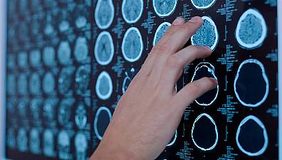 Poor Heart Health Predicts Premature Brain Ageing, Study Suggests