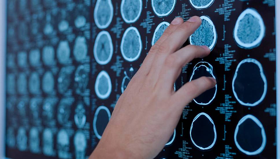 Poor Heart Health Predicts Premature Brain Ageing, Study Suggests