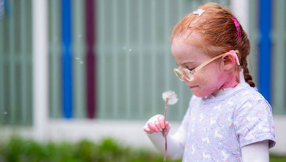 Girl With Rare Skin Disease Stars In Book Explaining Disorder To Classmates