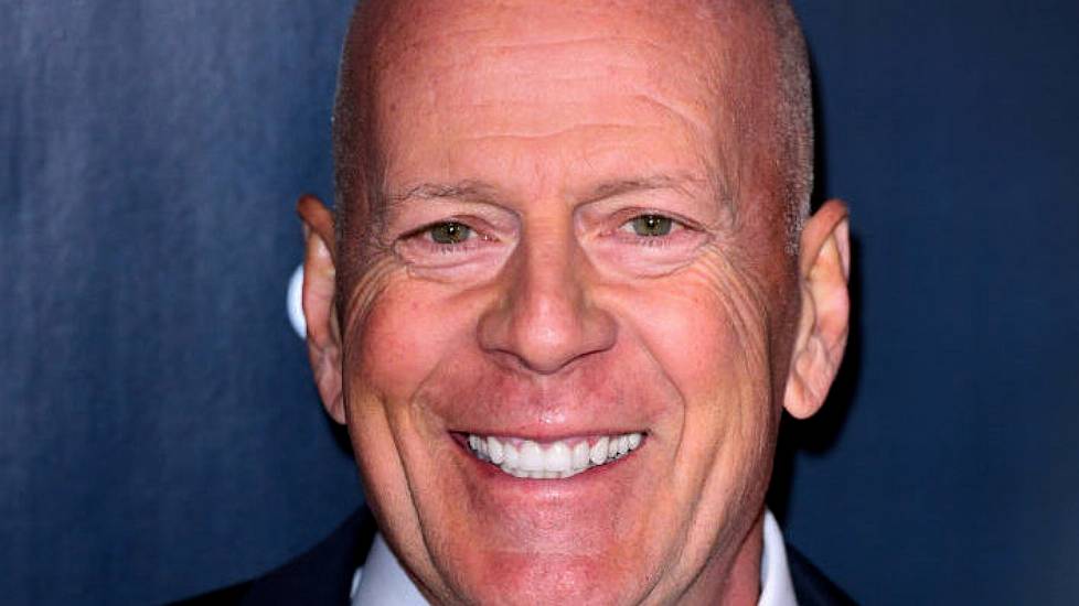 What Is Frontotemporal Dementia? Bruce Willis’s Condition Explained