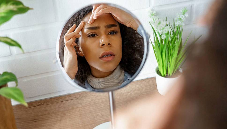 Struggling With Adult Acne? These Are The Common Causes And Treatments