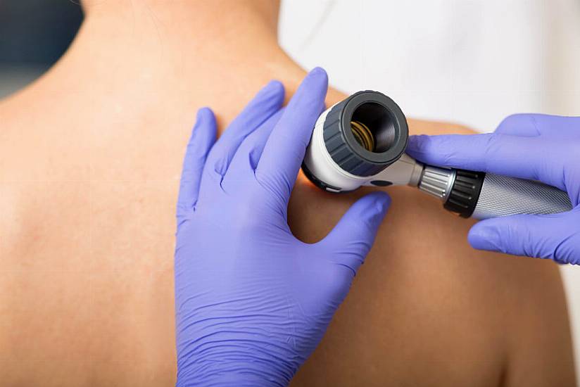 Skin Cancer Cases Reach Record High – How To Spot The Signs