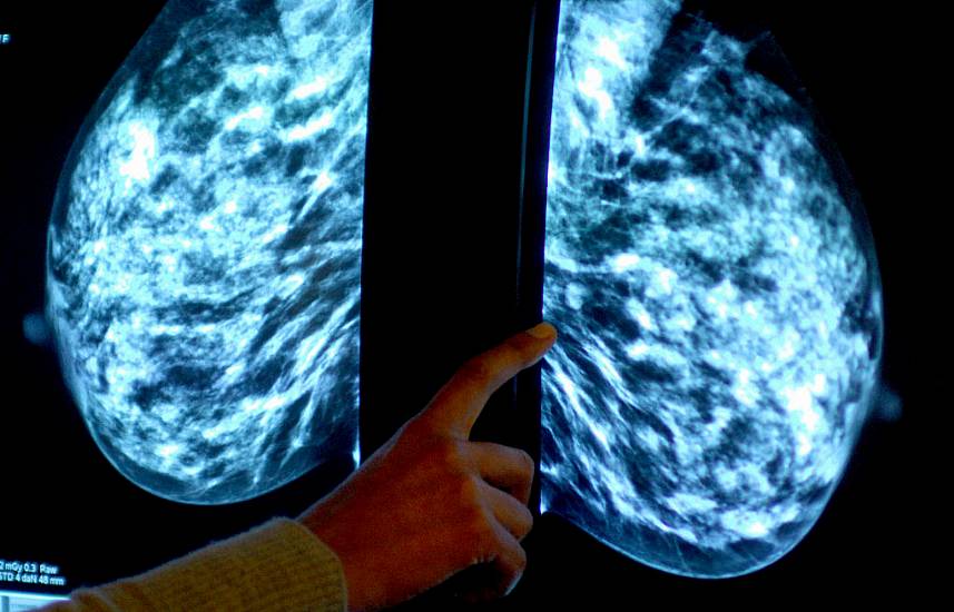 'Ai May Be Able To Safely Assess Breast Cancer Scans', Study Finds