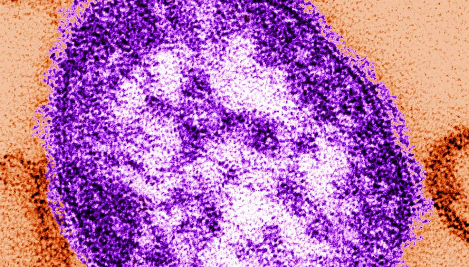 Passengers On Dublin To Tipperary Bus Exposed To Measles