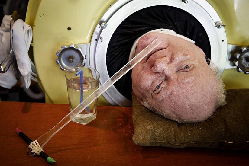 Polio Sufferer Who Was In An Iron Lung For Decades Dies Aged 78