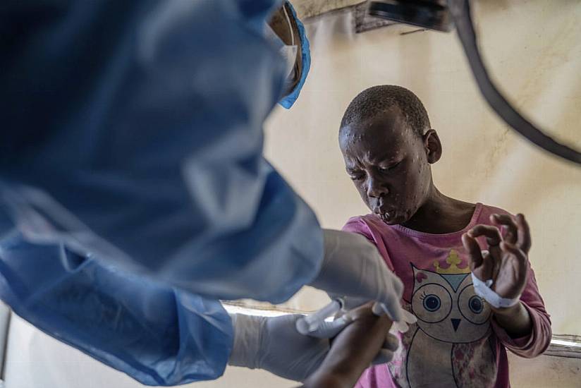 Democratic Republic Of Congo Reports More Than 1,000 New Mpox Cases In A Week