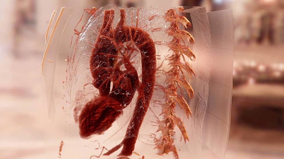 Structures Described By Da Vinci ‘Crucial To Understanding How Heart Works’