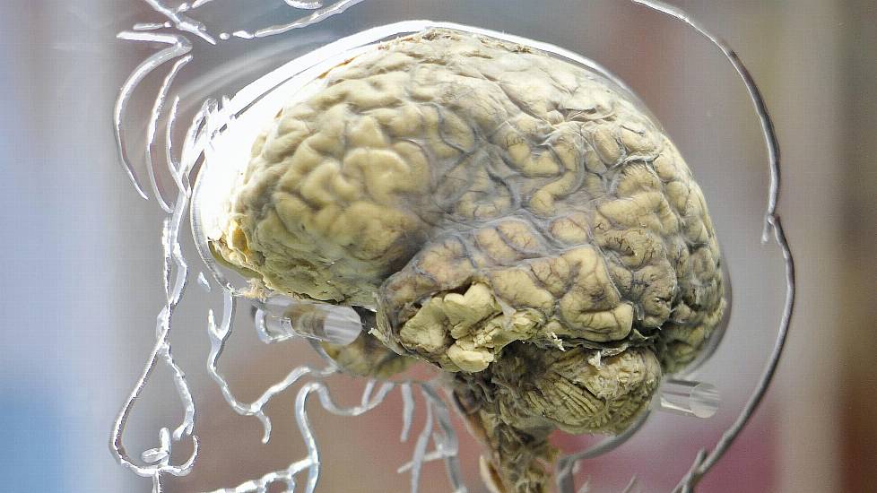 ‘Reversed Brain’ Linked To Lower Social And Communication Abilities – Study