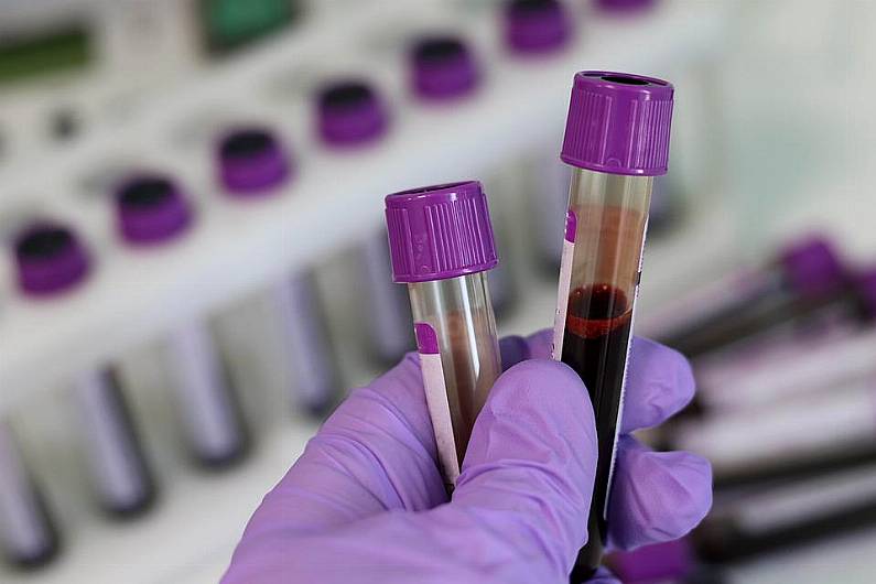 &euro;460 reimbursed to medical card holders in Kerry and Cork for incorrect charging of blood tests